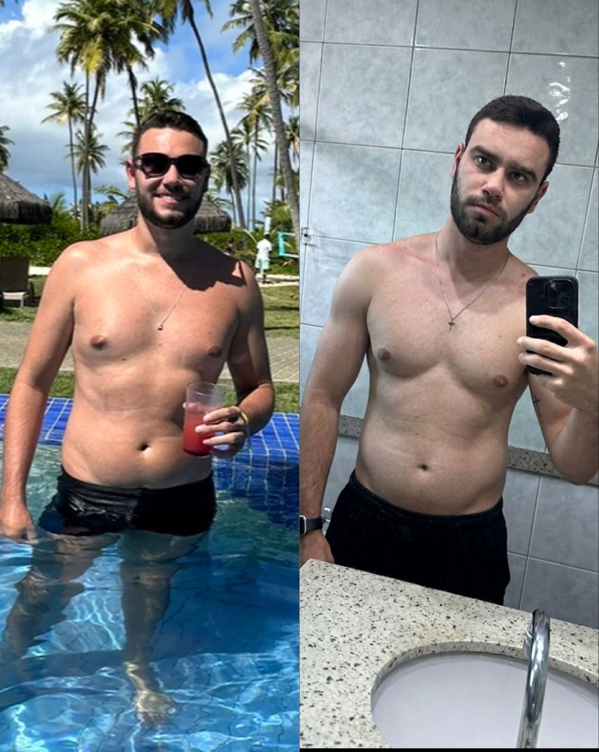 Antes e depois — Carlos Augusto Costa